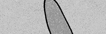 APOIO DE RESINA COMPOSTA NA PALATINA DE INCISIVOS SUPERIORES Fig.32. Bite turbos (EPSTEIN,1999) impedindo torque anterior (EPSTEIN,1999) Referências Bibliográficas AL BURAIKI, H.