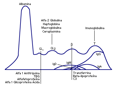 AVALIAÇÃO LABORATORIAL DA ELECTROFORESE DAS PROTEÍNAS Electroforese da Urina A electroforese de proteínas da urina, assim como do soro, é uma técnica simples para separar as proteínas presentes na