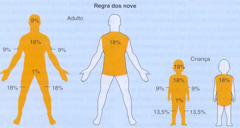 Alongar, fazer compressas de gelo e massagear os músculos doloridos são ações que podem ser úteis.