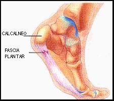 Indicações Clássicas Pseudoartrose de Fraturas