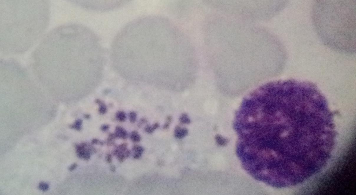 Detecção de Leishmania por qpcr Proteção Carga parasitária Bone marrow smear with macrophage