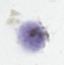 Taxa de ingestão após a incubação de sangue total com 10 e 50 μm de hemozoína durante quatro horas. O painel A representa a taxa de ingestão de hemozoína por granulócitos e o painel B por monócitos.