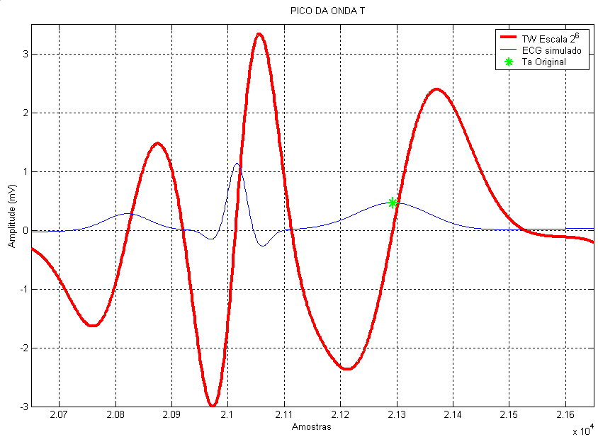 88 Resultados obtidos Figura 5.1: Ilustração de batimentos de ECG simulado(traço fino, azul) obtido a partir do simulador de McSharry et al.