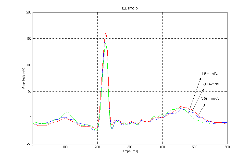 Resultados obtidos 105 obtido no próximo ao (mas ainda acima do) limite inferior da faixa de normoglicemia (3,50 mmol/l). Figura 5.