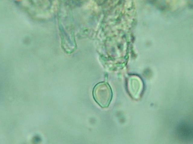 Basidiomicetos Classe Agaricomycetes Microscopia das estruturas