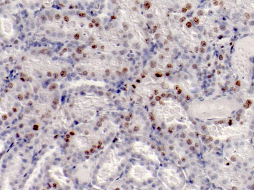 Morfometria para Ki-67 Observou-se a intensa presença de células mitóticas nos túbulos renais, indicada pela marcação intranuclear (Figura 40).