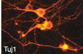 Detecção da presença de marcadores neuronais: As células após 14 dias em meio neuronal deverão exibir características de células neuronais, tais como a polaridade e morfologia complexa e expressão de