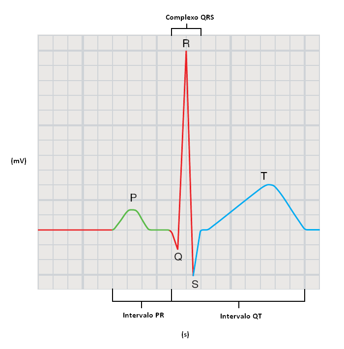 designados com letras sucessivas do alfabeto P, Q, R, S, T e U, tal como demonstrado na Figura 16, situada abaixo. Figura 16 - Sinal de ECG e respetivas ondas.