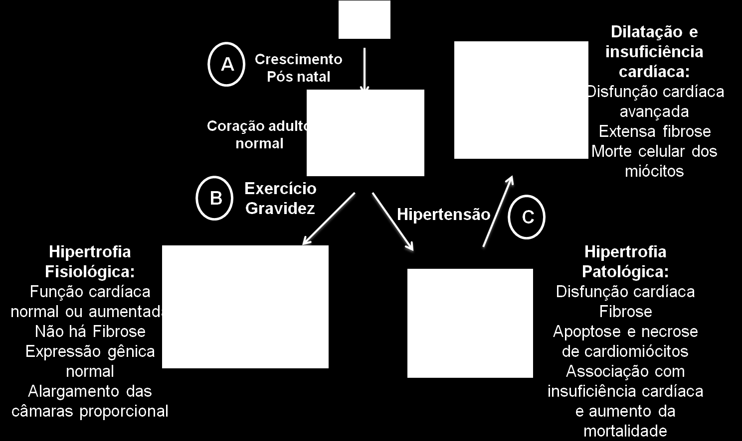 18 Figura 1 - Hipertrofia cardíaca fisiológica e patológica. (Adaptado de BERNARDO et. al., 2010) A hipertrofia cardíaca patológica pode ser classificada em concêntrica e excêntrica (Figura 2).