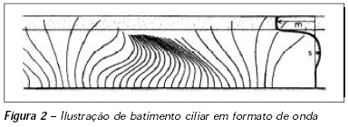 Exames Auxiliares de Diagnóstico CONFIRMAÇÃO DO DIAGNÓSTICO Análise do padrão e frequência do movimento