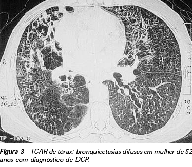 Seguimento Centros com experiência. Provas de função respiratória.