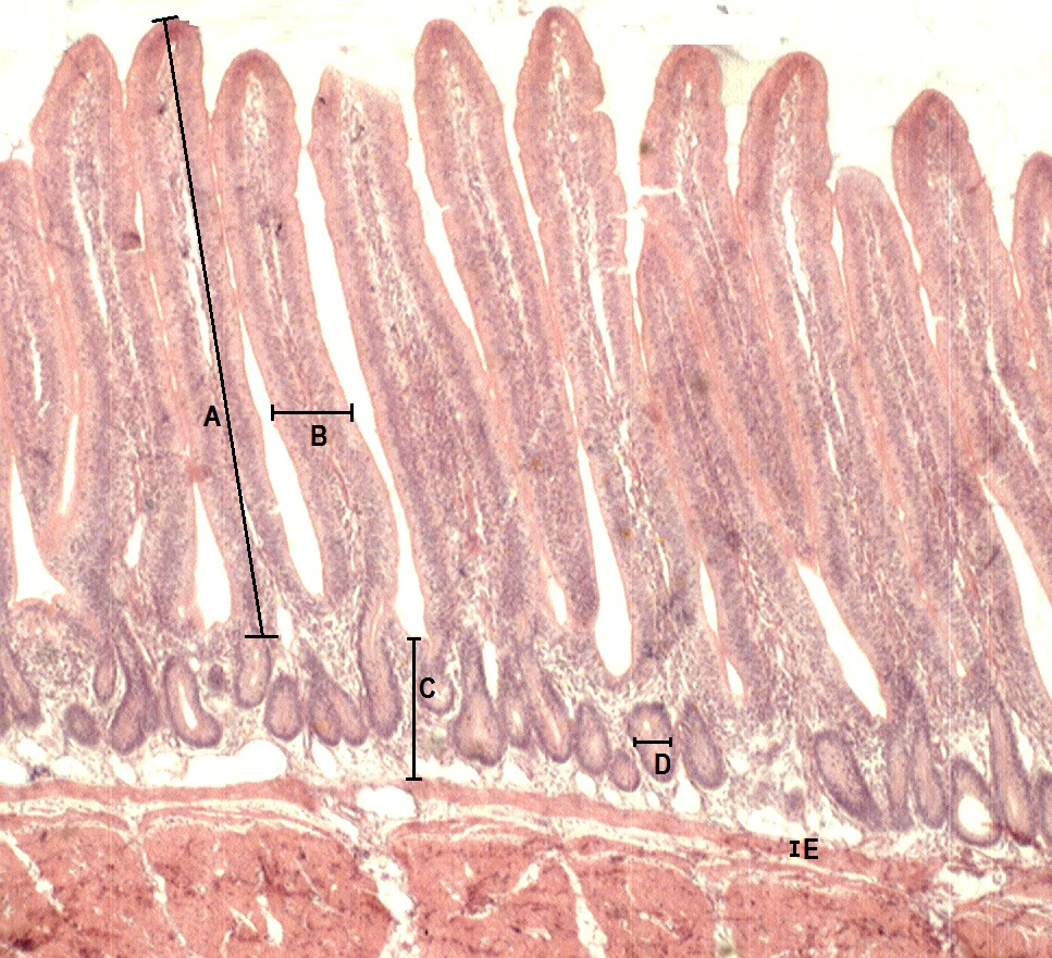 Após a coleta, os fragmentos dos segmentos de intestino foram lavados com solução salina a 0,9% e submergidos em líquido fixador de Alfac (85mL de álcool 80%, 15mL de formaldeído(37-40%) e 5 ml de