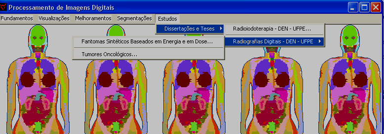 Figura 6- Janela principal do software DIP mostrando no menu Estudos o submenu Dissertações e Teses- Radiografias Digitais (VIEIRA et al., 2007) 3.