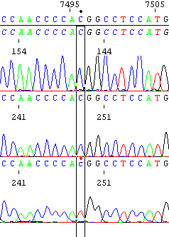 4.1 Estudo Genético de alterações no mtdna em controlos A análise das sequências estudadas, por sequenciação automática, das 8 regiões em estudo do mtdna de 210 indivíduos saudáveis, comprova que as