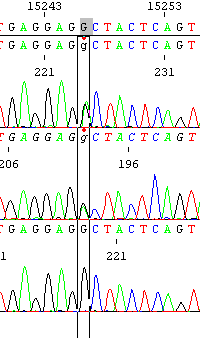 Os eletroferogramas mostrados na Figura 9 correspondem à alteração m.15246g>a, detetada em heteroplasmia no doente 3: na posição m.