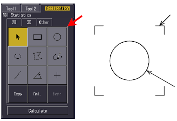 Apresentação da Imagem/Processamento da Imagem Apresentação da Imagem/Processamento da Imagem Os procedimentos para determinação de número TC, determinação de distância e de ampliação de imagem são