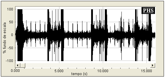 81 (1) (2) (3) (4) (5) (6) Figura 54 Seleção de seis imagens gravadas pelo tomógrafo entre os quadros 7900 e 8100, durante um movimento respiratório completo.