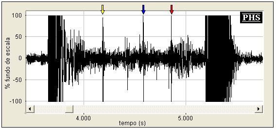 83 As figuras 57 e 58 ilustram, respectivamente, a representação temporal e o espectrograma de uma ampliação do intervalo de tempo da figura 55, que tornam mais clara a visualização dos ruídos de