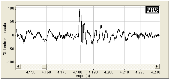 84 Figura 59 - Representação temporal de um intervalo de 90ms de gravação dos sons respiratórios durante a fase inspiratória.