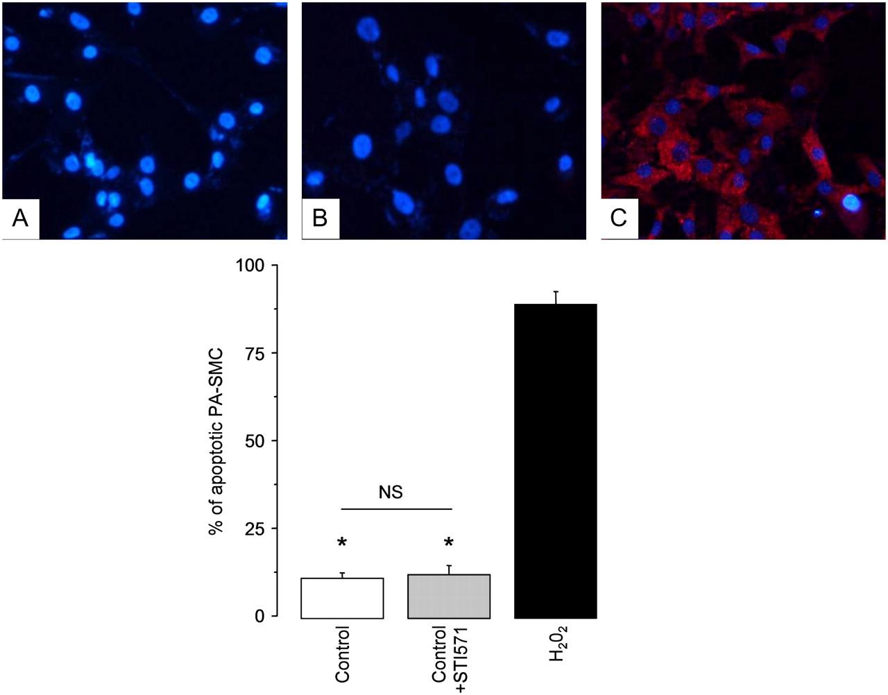 Apoptose: metodologia de avaliação Imunofluorescência Atividade de caspase Substrato de