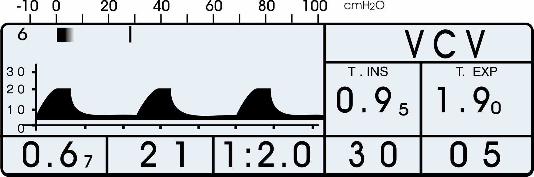 7.2 Tela Principal Esta é tela apresentada normalmente durante a ventilação, estando exemplificada na Figura 7.3.