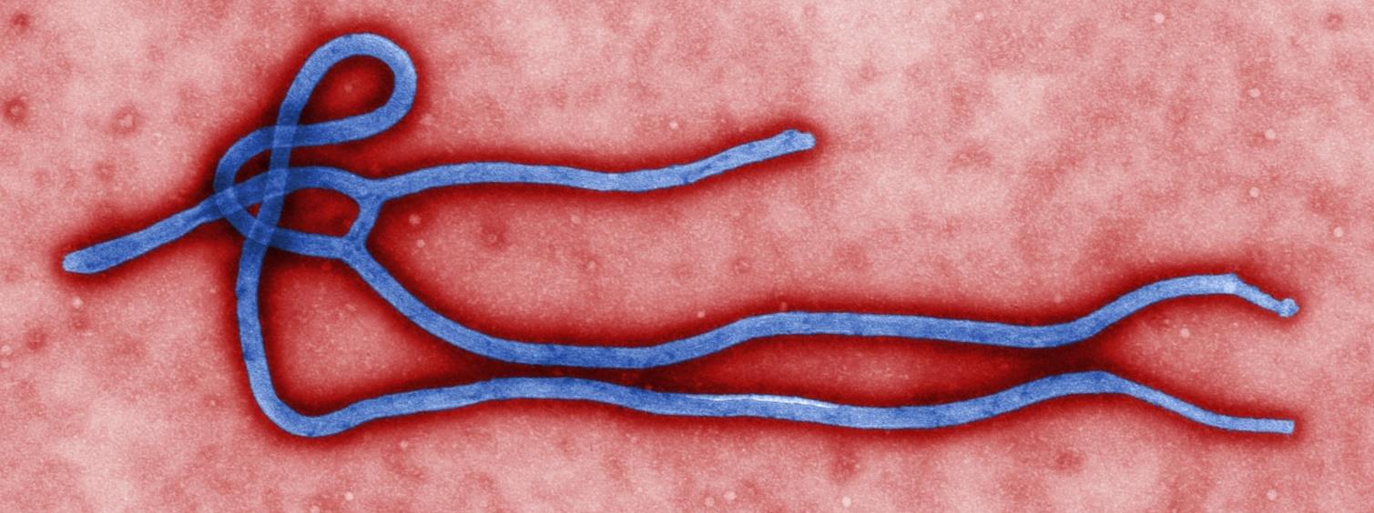 Emergência de Saúde Pública de Importância Internacional ESPII pelo vírus Ebola Trata-se do maior