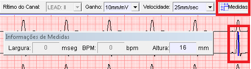 9.5.2 Ferramentas Possui as opções para configurar a conexão do equipamento e armazenamento de dados, e também habilitar os atalhos para funções diversas. 9.5.2.1 Configurações Informe o endereço IP do CardioTouch 3000.