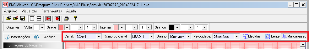 Descrição e composição da Barra de Cores A Barra de Cores ajusta as seguintes opções: Padrão retorna aos ajustes originais de fábrica; Fundo define a cor de fundo; Grade define o tipo de linha e a