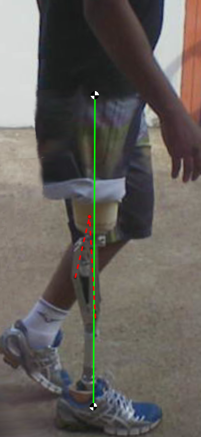 de quatro barras, onde o comprimento das barras determina a trajetória do centro instantâneo de rotação, localizado na intersecção dos prologamentos das barras que unem a peça superior do joelho,