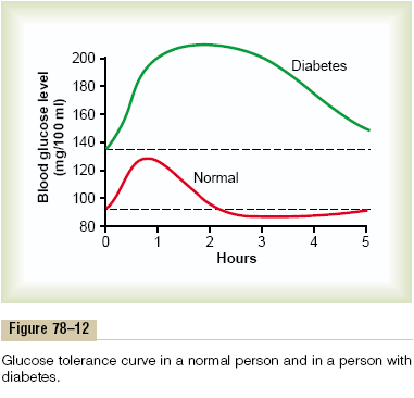 Fisiopatologia DM Tipo 2 Causa: - Obesidade e estilo de vida Efeito: defeito na secreção de insulina, na sua ação ou ambos.