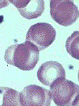 Hemácias vistas em microscópio eletrônico de varredura Hemácias coradas e vistas em microscopia óptica Algumas descobertas importantes na história da microscopia óptica.