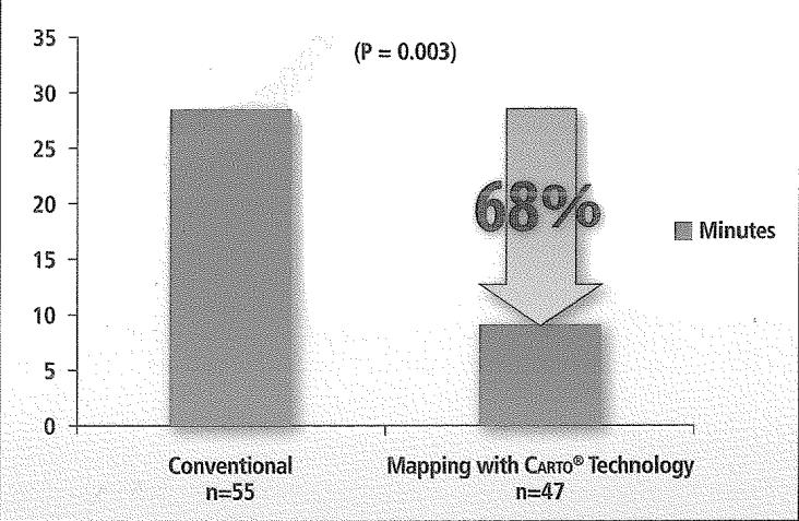Mapeamento Eletroanatômico Tridimensional Benefícios A utilização do Mapeamento Eletroanatômico está associado com uma drástica redução no tempo de fluoroscopia e dose de radiação 1.