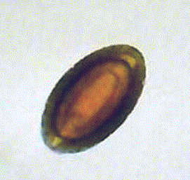 -Localização: intestino delgado -HD: suínos -HI: besouros -Inflamação da mucosa (pela fixação da probóscide) -Formação de granulomas na parede do intestino delgado -Anorexia -Perda de peso -Dores