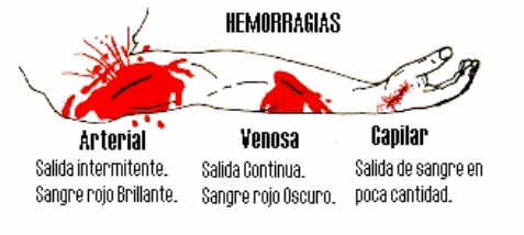 DESMAIO: Perda temporária da consciência por diversos motivos: falta de alimentação, cansaço, estresse, medo, etc.