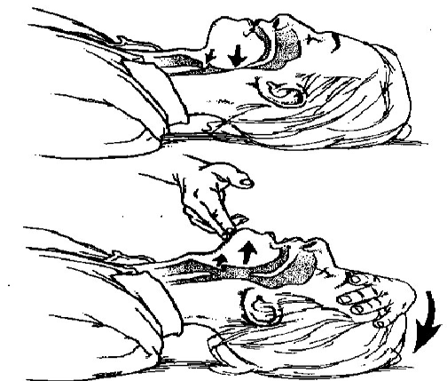 1.3 ASSISTÊNCIA RESPIRATÓRIA PRÉ-HOSPITALAR Conceitos Importantes: Parada respiratória: Supressão súbita dos movimentos respiratórios, que poderá ou não, ser acompanhada de parada cardíaca.