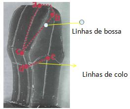 g) Os quatro quadrantes dos diedros axiais da coroa obterão as áreas expulsivas. Figura 16a - Região expulsiva (A) e retentiva (B).