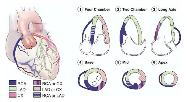 Anexo 6 Distribuição da perfusão das artérias coronárias no miocárdio. Fonte: Lang, R. M., Bierig, M., Devereux, R. B., Flachskampf, F. A., Foster, E., Pellikka, P. A., Stewart, W. J. (2005).