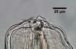 A B C EM D PCv E F Vu EM EG ED EE A PCd G H Figura 52 Aspectos morfológicos de Synhimantus (Dispharynx) nasuta.