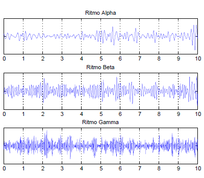 49 Tabela 3: Principais ritmos de EEG descritos na literatura. Banda Frequência Condições de Ocorrência Delta (δ) 0,5 3,5 Hz Ocorre em estados de sono profundo e doença cerebral orgânica grave.