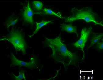 34 ALEXA 488 DAPI MERGE Figura 11: Células derivadas de