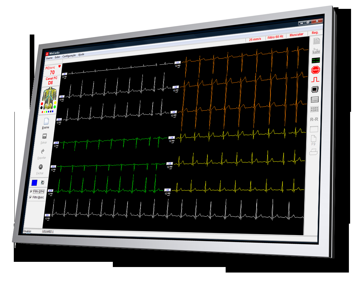 Benefícios O Sistema de Telemedicina em Cardiologia irá proporcionar os seguintes benefícios: Atendimento à população no seu local de origem, com rapidez e feito por especialistas médicos; Redução no