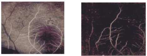 Exemplos: Imagens Médicas Transformada de Fourier
