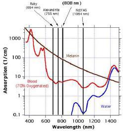 Características: 1. A Máquina de depilação a laser de díodo 808nm utiliza a mais avançada tecnologia que penetra na pele, garantindo um bom desempenho, efeitos clínicos e alta segurança. 2.