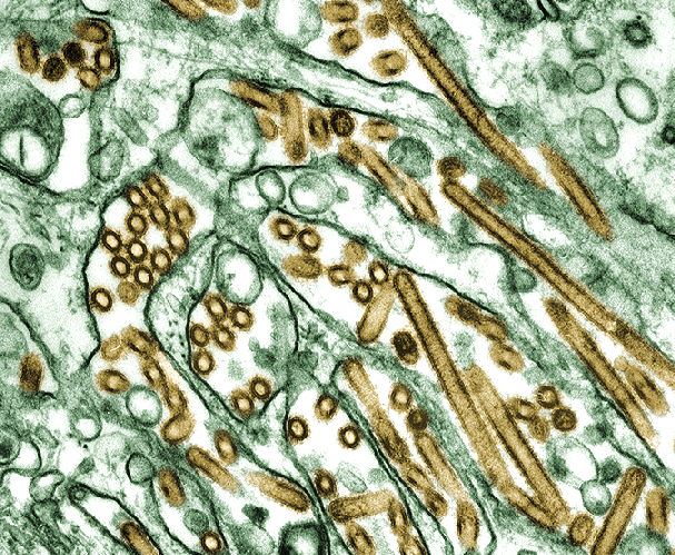 Figura 1- vírus H5N1 Fonte: OMS (Organização Mundial da Saúde) Estas partículas não permanecem suspensas no ar, mas atravessam uma distância pequena (geralmente 1 metro ou menos) e se depositam