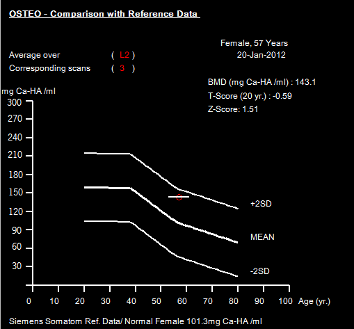 Figura 4.31 - Resultados estatísticos, com representação gráfica, da vértebra L2. Relativamente à vértebra L3, cuja definição dos contornos e resultados se encontram nas Figuras 4.32 e 4.