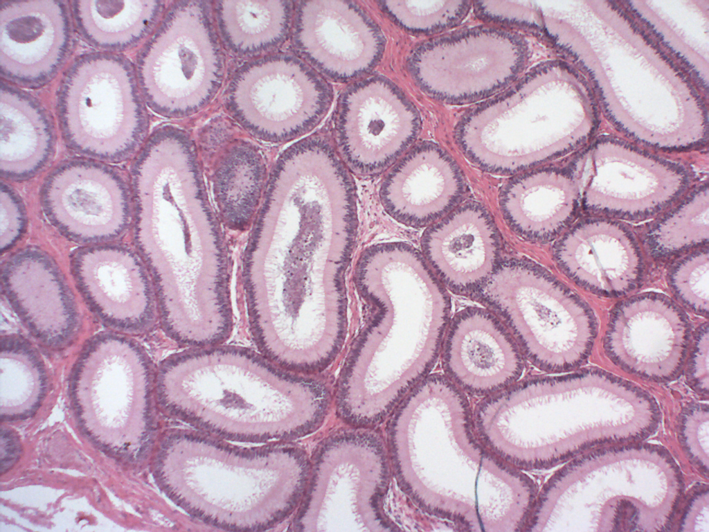 16 Tecido epitelial de revestimento pseudoestratificado cilíndrico com esteriocílios Figura 1.19 Corte de epidídimo. Coloração: Hematoxilina e Eosina.