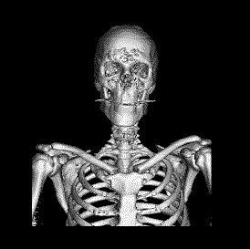 Revisão da Anatomia do SISTEMA ESQUELETICO Os ossos são órgãos esbranquiçados, muito duros, que unindo-se uns aos outros, por intermédio das junturas ou articulações constituem o esqueleto.