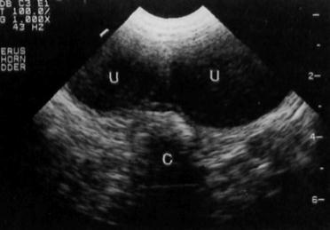 Figura 10.1 Ecografia abdominal representando útero normal, cólon e bexiga (Adaptado de Dickie, 2006) Figura 10.