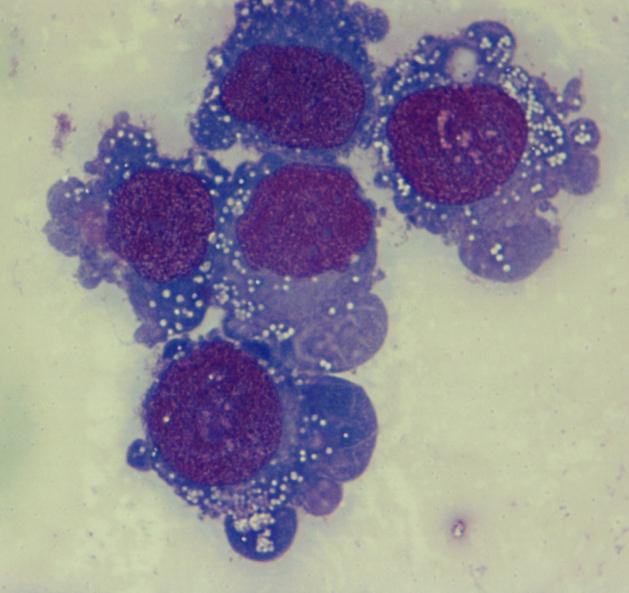 Posteriormente, foi avaliado se os efeitos do Imatinib na redução da viabilidade das células sensíveis ao Imatinib eram mediados por mecanismos de morte celular programada.