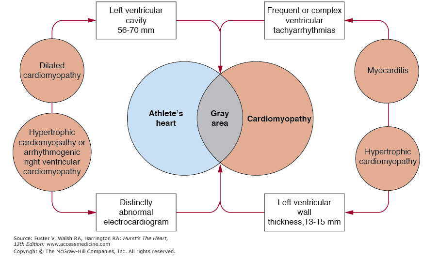 Figura 2 - Zona cinzenta que sobrepõe o "coração de atleta" e a cardiomiopatia Cardiomiopatia Hipertrófica A cardiomiopatia hipertrófica (CMH) é a principal causa de morte súbita em jovens atletas